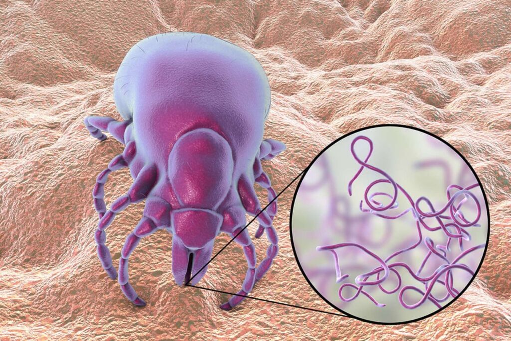 Lyme xronia nosos